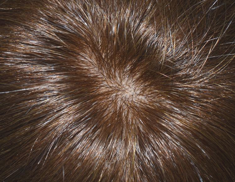 Baza ze wstawką silk part Baza ze wstawką silk part