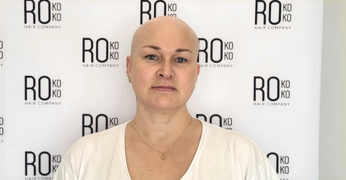 Zdjęcie przed metamorfozą z systemem włosów Hair Again